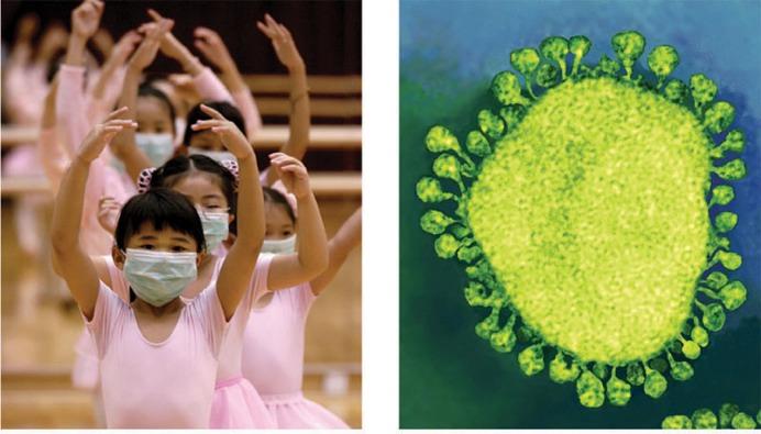 Severe acute respiratory syndrome (SARS) Recently appeared in China Figure 18.11 A, B (a) Young ballet students in Hong Kong wear face masks to protect themselves from the virus causing SARS.