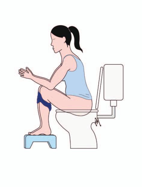 If you become very constipated and are having difficulty emptying your bowels speak to your GP who may suggest mild medication to help keep your bowels moving.