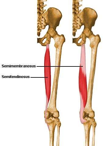 Pathophysiology Semitendinosus and semimembranosus have different configuration