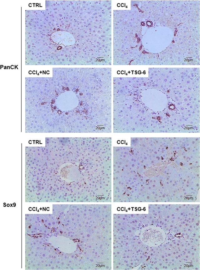 Wang et al. Stem Cell Research & Therapy (2015) 6:20 Page 8 of 14 Figure 5 TSG-6 decreases the proliferation of hepatic progenitors in the liver damaged with CCl 4.