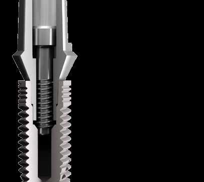 CONEXA THE REVOLUTIONARY CONNECTION PROSTHETIC SCREW The only function is to bring in total connection the abutment and the implant. It is not subjected to loads, eliminating the risk of breakage.