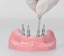 Place the impression post accurately into the implant and tight