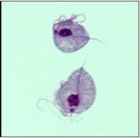Fig 2.3: Two T. vaginalis parasites, magnified (seen under a microscope 40x) (CDC, 2012). b. Culture: According to Mabey et al.