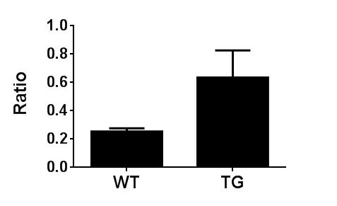 Detection of Activated AMPK (pampk) in TG and WT