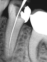From a professional picture to an exact diagnosis DÜRR X-RAY FILM PROCESSING Facts in black and white Causal dental medicine presupposes an exact diagnosis on the basis of X-ray pictures.