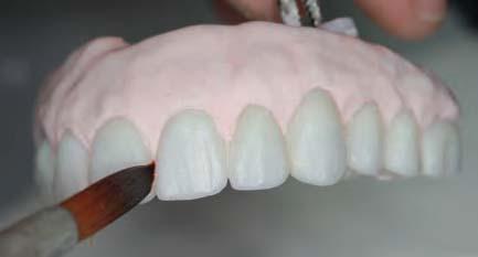 22 Final staining and gingival colorization creates a natural appearance - occlusal view. Fig.