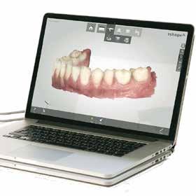 Digital Impressions, a world of advantages For the dental clinic Faster impression taking. Eliminate inaccuracies.