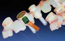 16 Advanced medical technology applied to the dental sector Core3dcentres uses the most