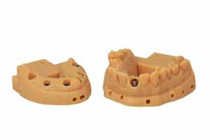 implant restorations in zirconia, PMMA and other materials.
