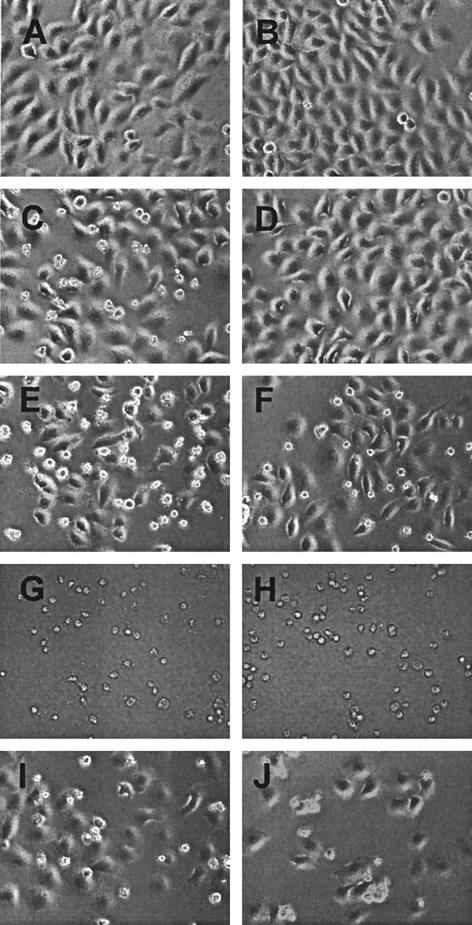 4666 KOPECKY AND LYLES J. VIROL. FIG. 7. Images of cells transfected with M mrna or treated with inhibitors of host gene expression in the presence of a caspase-8 inhibitor.
