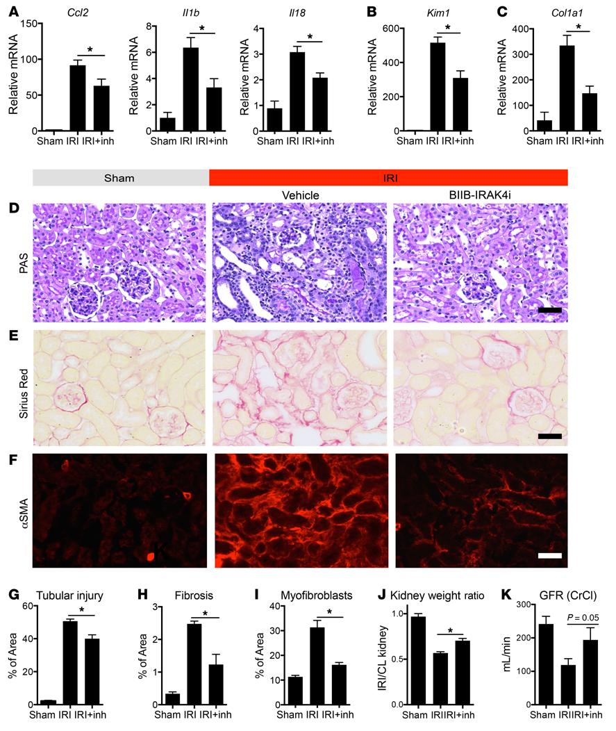 The Journal of Clinical Investigation RESEARCH ARTICLE Figure 6. IRAK4 inhibition attenuates inflammatory and fibrotic responses in vivo and improves organ function.