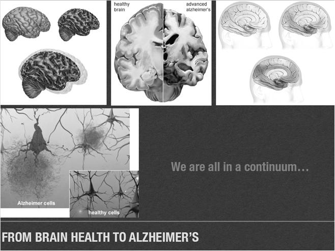 Primary prevention of Alzheimer s disease and related
