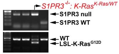 Two major activities were achieved in this report period. First, we have successfully generated the S1PR3 -/- : LSL-K-Ras G12D bi-transgenic mice.