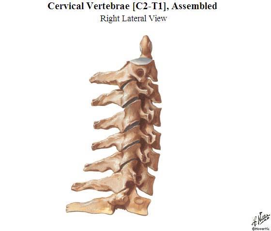 Review Which cervical vertebrae has the most prominent spinous process?