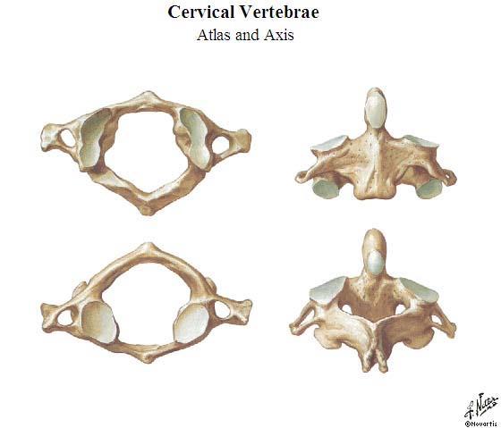 Which cervical vertebra has no body? C1 aka Atlas Which cervical vertebra has no spinous process C1 aka Atlas Which contains the dens?