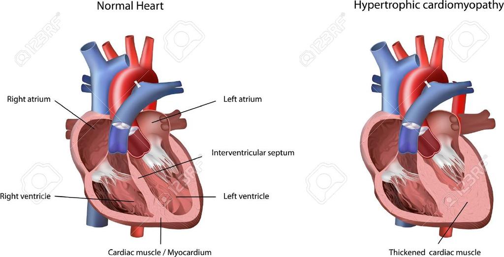 The Heart Myocardiummuscle layer of the