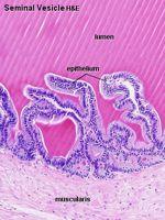 Seminal Vesicle - paired diverticula of vas deferens - 2 cm wide, 4 cm long - convoluted