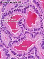 motility female immune suppression mucosa = - elaborate folding (honeycomb) - PSCCE or columnar -