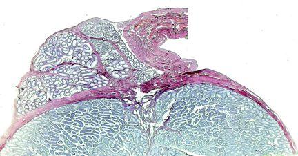mediastinum with rete testis - fibrous septae = 300 lobuli testis -