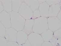 Adipocyte size (um 2