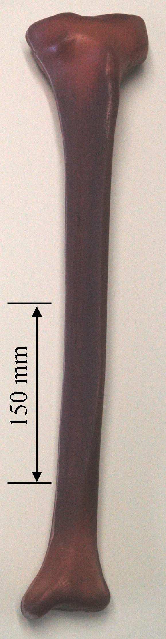 Proximal Bicortical screw holes 85 mm (a) (b) Distal Figure 1. Experimental model.