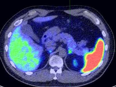 Adrenal medulla Bladder Kidneys Bowel