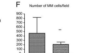 Development of Myeloma Bone Lesions Normal Mice Mice + tumor Mice + tumor