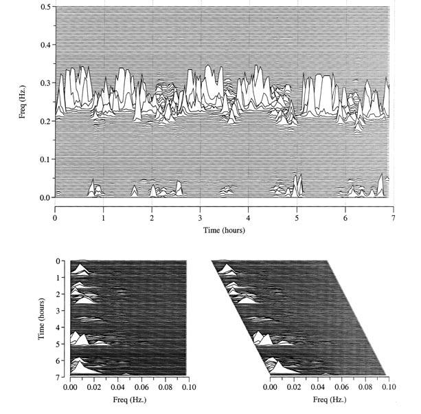 Figure 1 Sleep spectrogram in health.