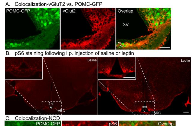 Supplementary Figure 4) Expression of ps6 and pstat3 in a subset of POMC neurons in the ARC following i.p. injection of leptin A) Images of fluorescence microscopy showing the expression of glutamatergic POMC neurons in the ARC.