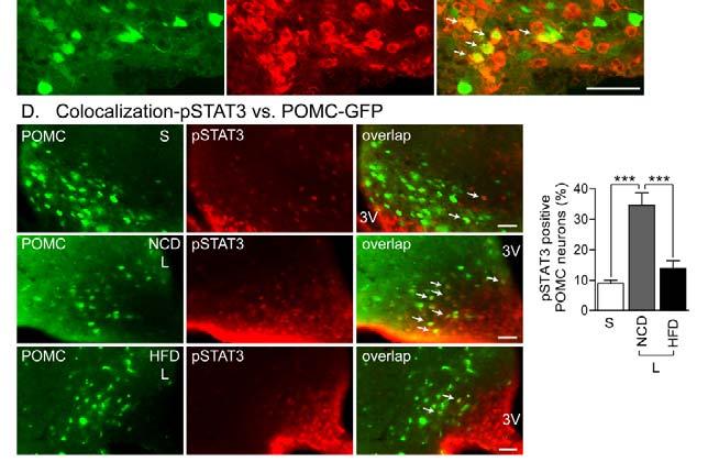 B) Images of fluorescence microscopy showing the expression of ps6 (Red) in the hypothalamus following i.p. injection of saline or leptin (1 mg/ kg).