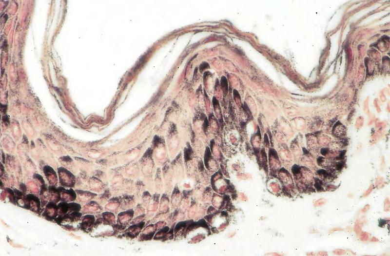 Normal epidermis and papillary dermis (high power). Melanin stains black in this Masson Fontana stain.