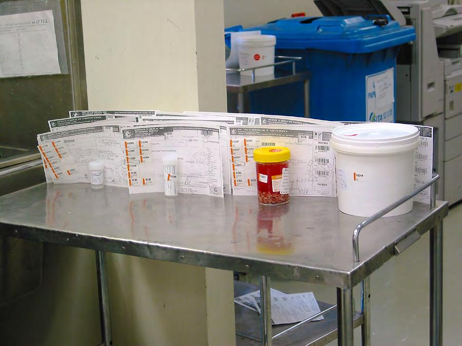 The specimen is placed in a container of formalin, labelled,