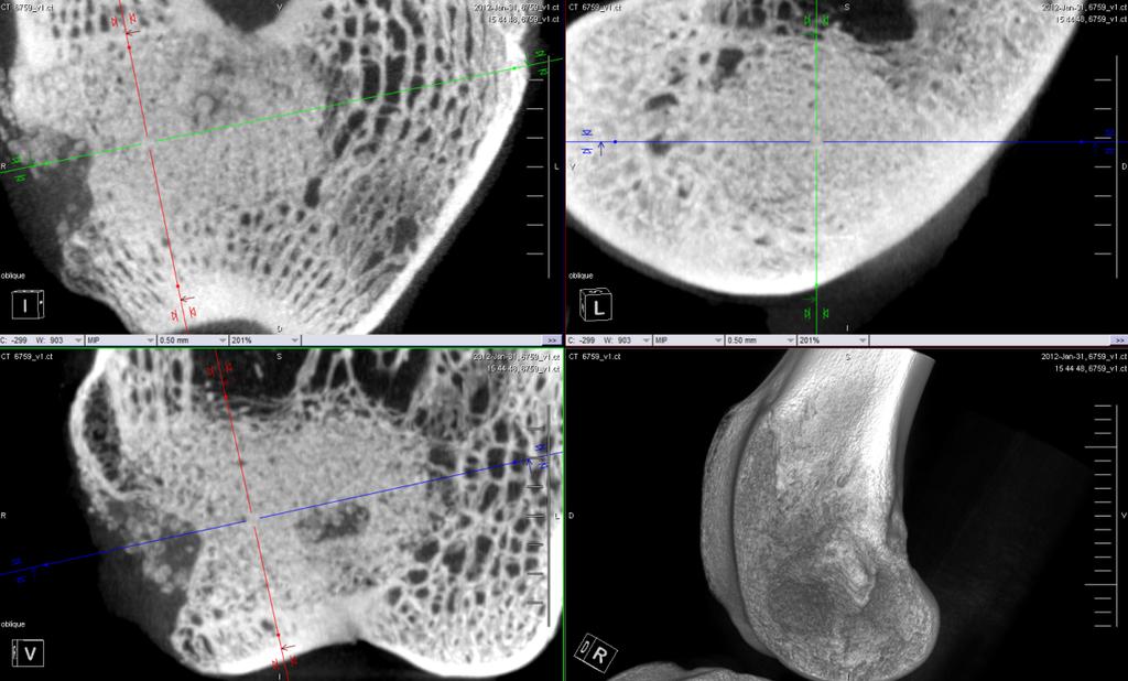 The images for the 6 week Novabone and Actifuse groups showed bone growth around the periphery of the defect. However, the bone had not yet reached the center.