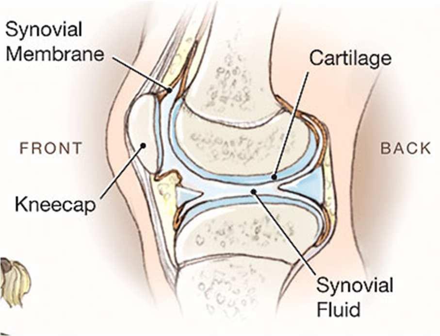 NORMAL DIARTHRODIAL JOINT Synovial is a thin membrane enclosing the joint space