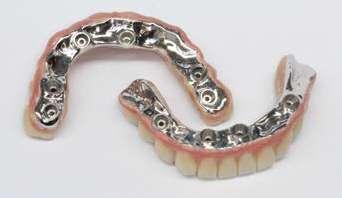 The metal zirconia full arches design is