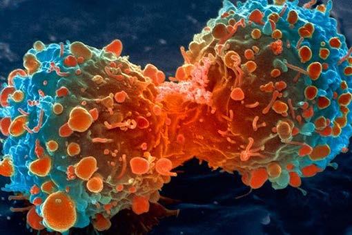 Fighting Some of the Most Deadly Diseases: Cancer Cancer is among the leading causes of death worldwide. In 2012, there were 14 million new cases and 8.