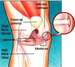 KNEE ARTHROSCOPY PATIENT INFORMATION SHEET Introduction It has been recommended that you undergo an arthroscopy of your knee.