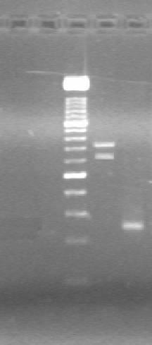 flu Serological and molecular diagnostic were established RT - PCR assay for molecular identification DNA