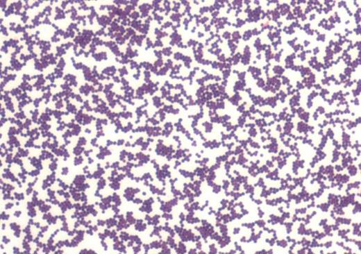 3 2 PREGLED OBJAV 2.1 BAKTERIJA Staphylococcus aureus V rod Staphylococcus uvrščamo po Gramu pozitivne koke s premerom približno 1 µm, ki se urejajo v nepravilne gruče (Slika 1).