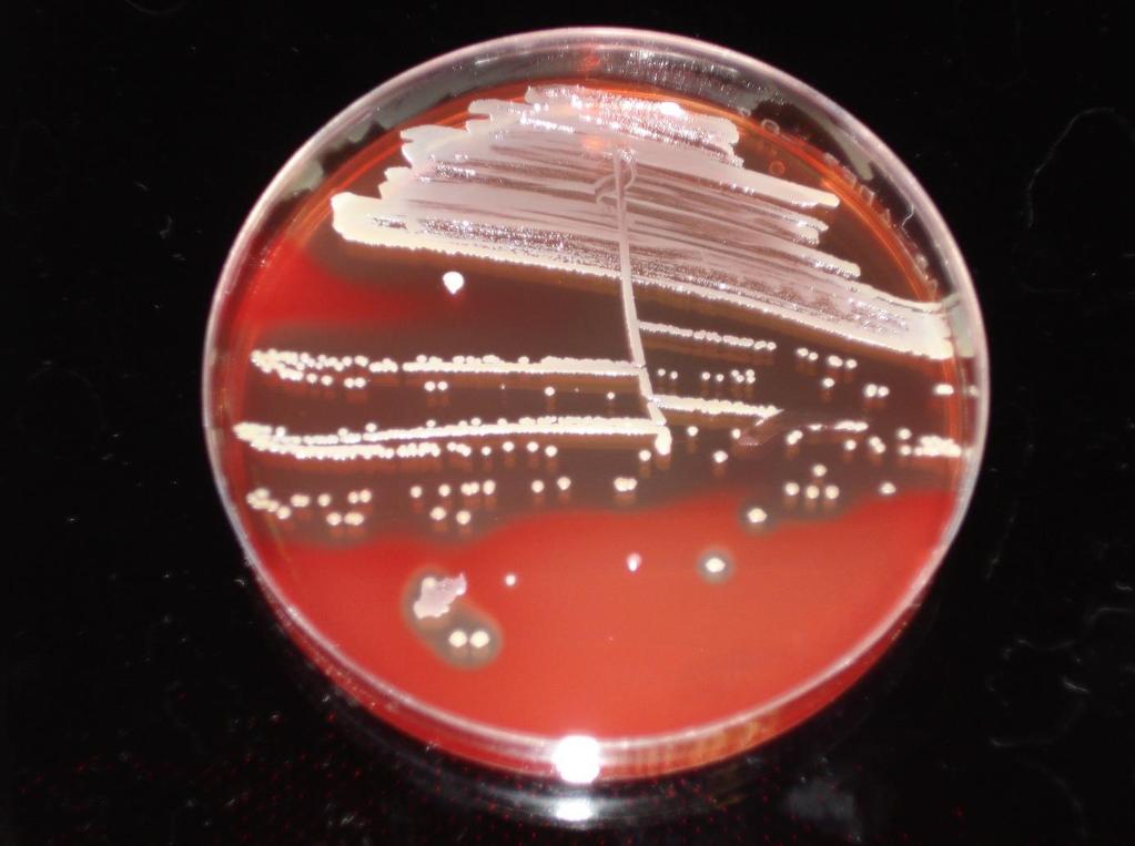 4 Slika 2: Staphylococcus aureus, rast na krvnem agarju (Foto: Pirš M., 2008). Figure 2: Staphylococcus aureus, growth on blood agar (Photo: Pirš M., 2008). 2.1.1 S.
