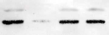 Western blot analysis of -treated nulear extrats. Serum-starved hondroytes (0.