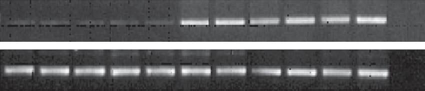 CCL20 156 bp GAPDH 248 bp Normal Chronic Rhinosinusitis + Figure 1.