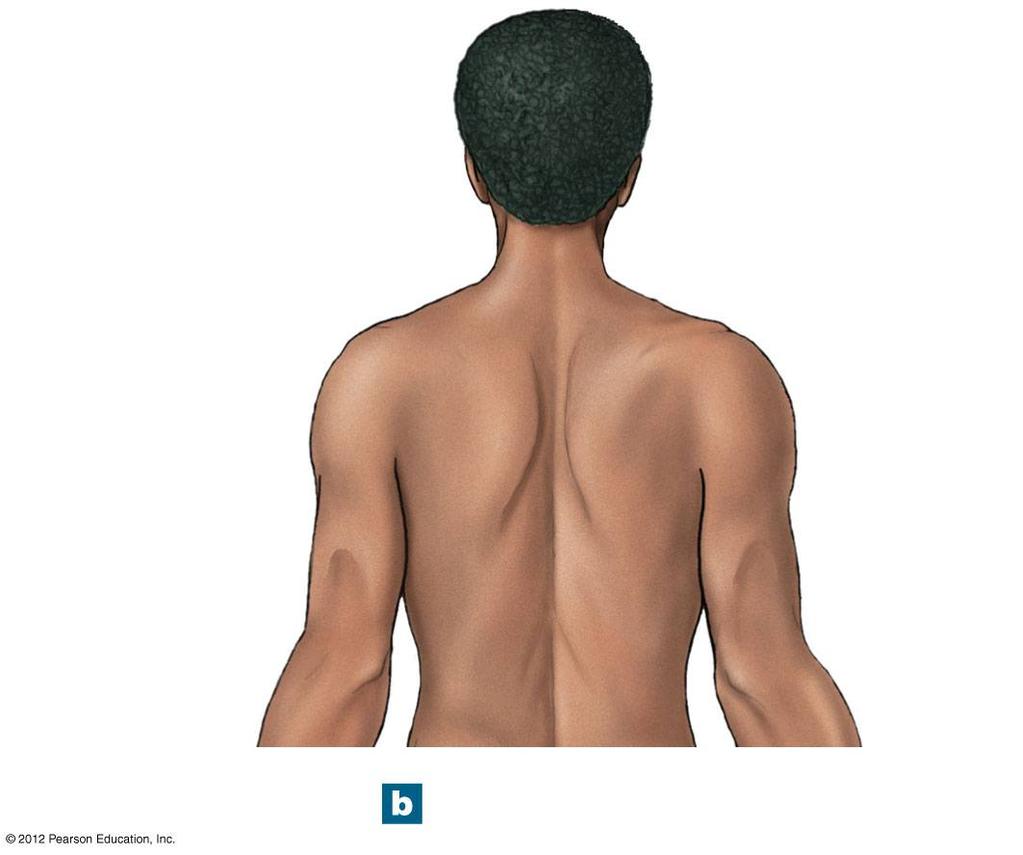 Figure 1-5b Anatomical Landmarks Cephalic or head Acromial or shoulder Dorsal