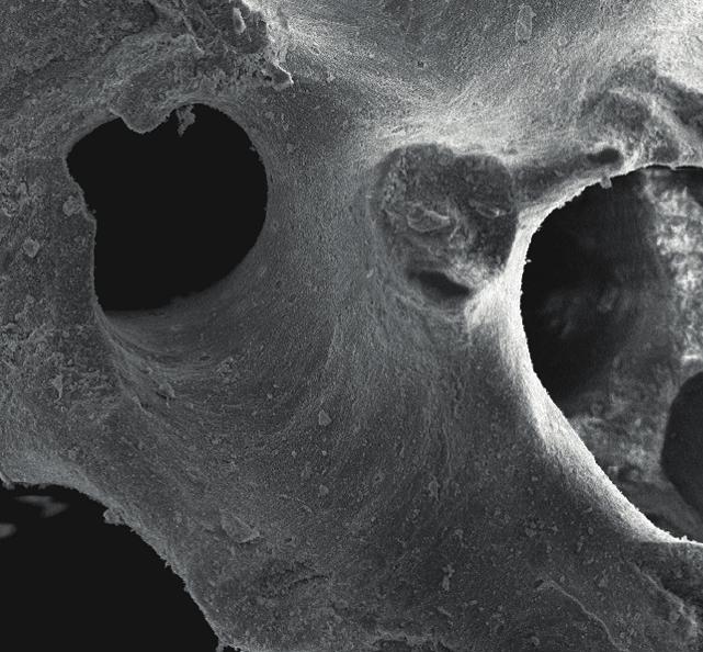 Symbios Xenograft Granules: SEM pictures shows interconnecting pores and the rough surface