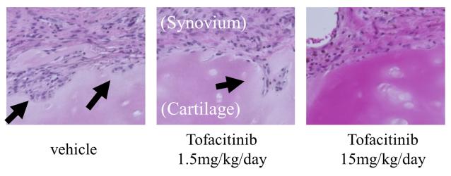 131 Fig.1 Tofacitinib suppressed RA cartilage destruction in SCID-HuRAg mice Rheumatoid arthritis synovium with articular cartilage were co-implanted onto the back of SCID mice.
