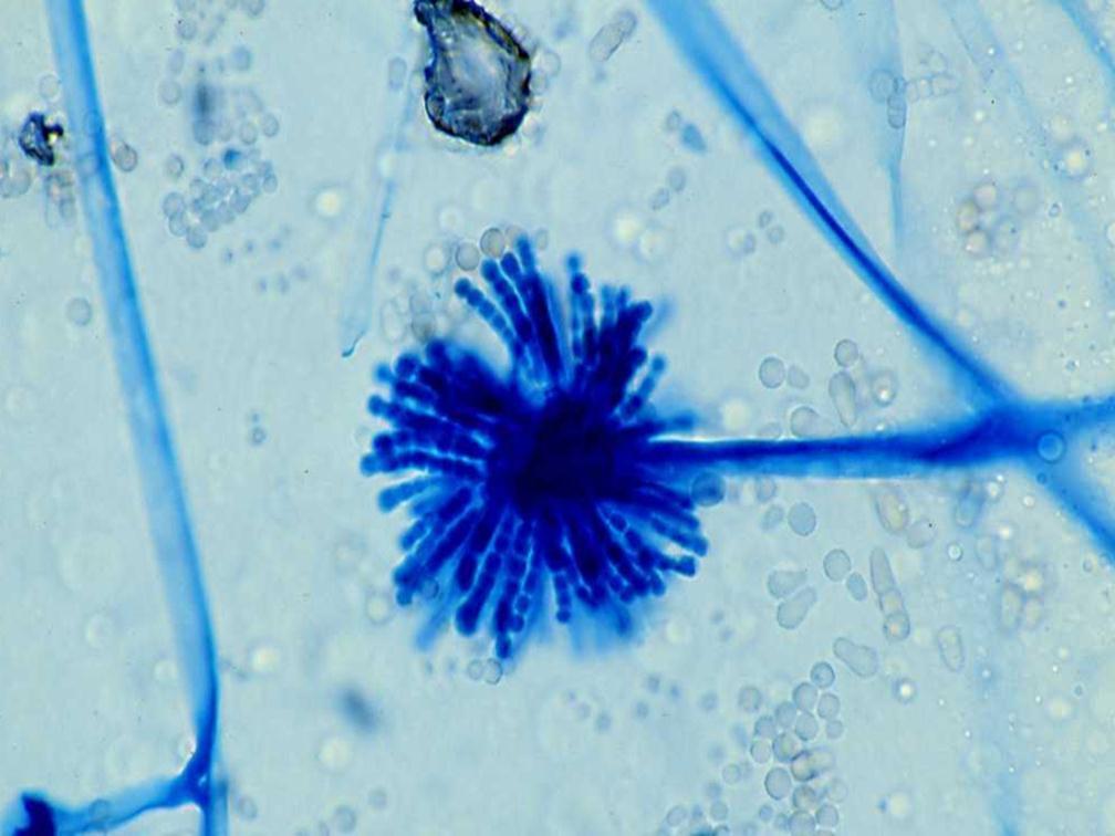 This is an example here of the tube-like structure of this sporangia that you see called
