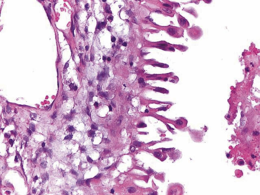 Immunohistochemical staining for Ki67 and p53 was performed on the representative samples of ovarian tissue.
