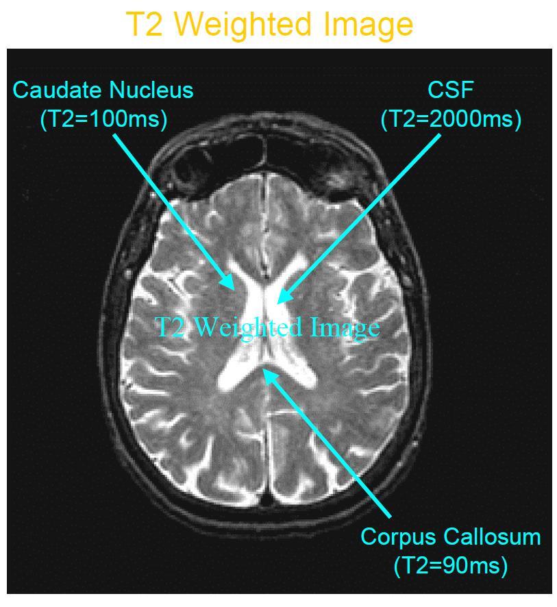 The fmri experiment 18 Significant clusters of activation from