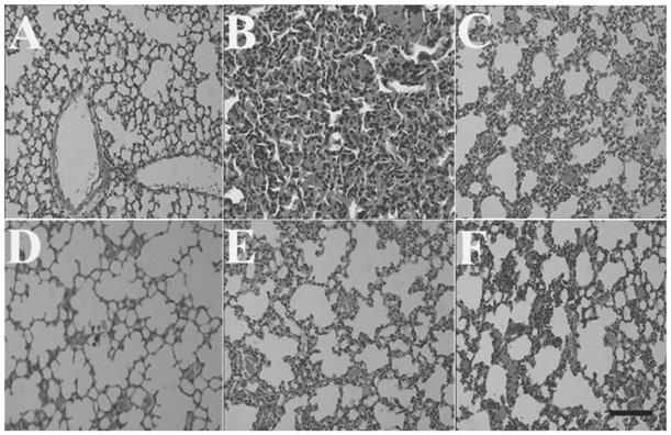 BIOMEDICAL REPORTS 1: 901-906, 2013 905 Figure 4. Effects of huperzine A sustained release microspheres (HSMs) on the histopathological changes of the lungs induced by methyl parathion (MP) Figure 5.
