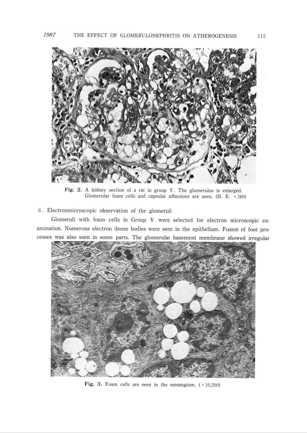 1987 THE EFFECT OF GLOMERULONEPHRITIS ON ATHEROGENESIS 'f!!";! ' **. ' ',,; 115 i 'T' rl* Frg. 2. A kidney section of a rat in group Rr. The glomerulus is enlarged.